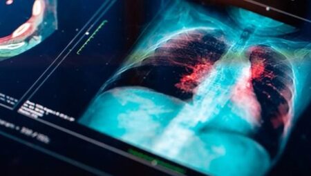 Devrim niteliğindeki robotik teknoloji, akciğer kanserini hem tedavi ediyor hem de önleyebiliyor