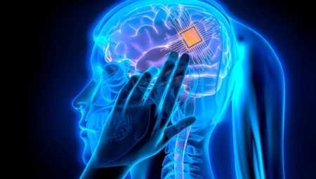 Elon Musk üzülebilir: Neuralink’in rakibi beyin implantı için onay almaya çok yakın